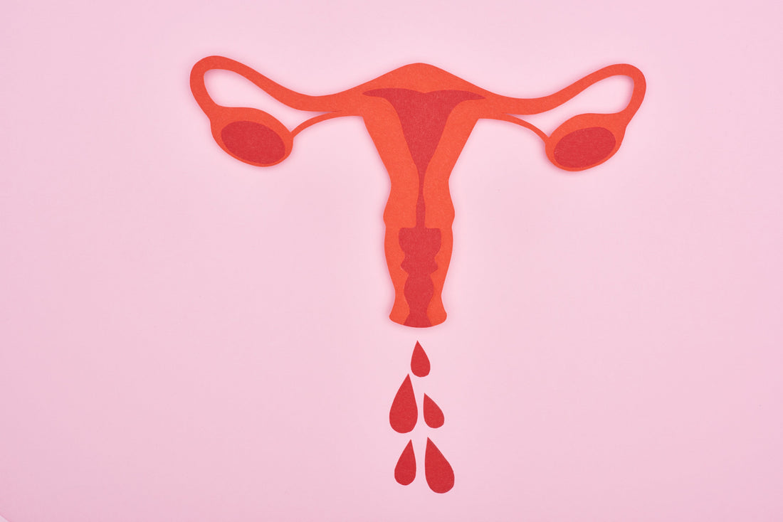 Gestion du flux menstruel abondant